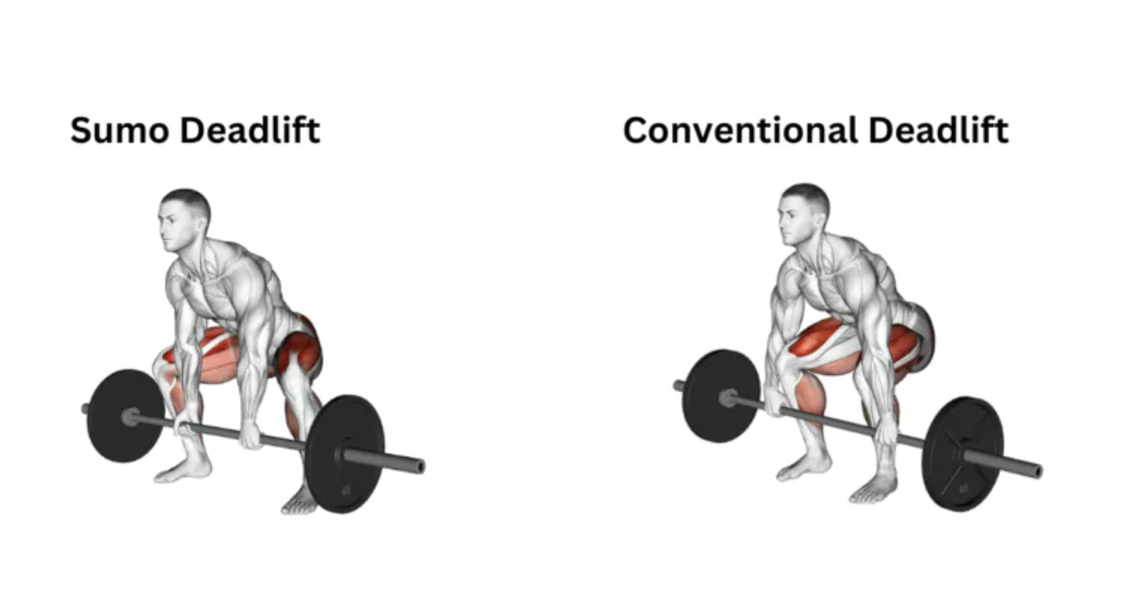 Sumo Deadlift Muscles Worked vs Conventional Deadlift