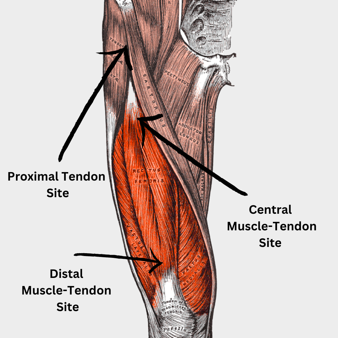 What does pendulum squat work?  Quadriceps